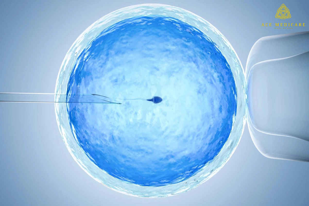 Demystifying ICSI: A Comprehensive Guide to Assisted Reproduction